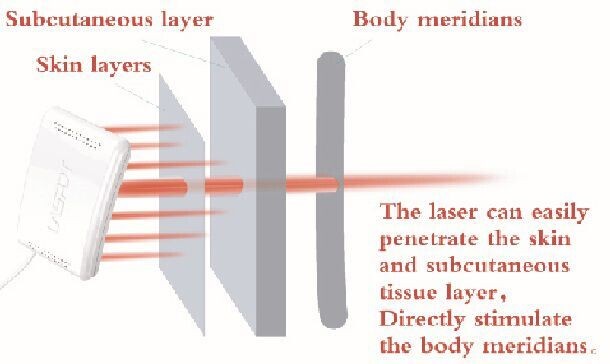 Reloj de nivel inferior del laser de la terapia del alto de sangre del laser de Hemotherapy del azúcar colesterol de la viscosidad
