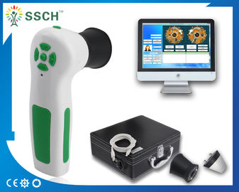 Analizador blanco de la diagnosis del analizador de la piel de la cámara USB de Iriscope Iridology