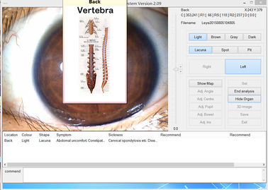 Analizador médico del iris del ojo de la cámara digital del megapíxel del alcance del iris de 12.0MP USB