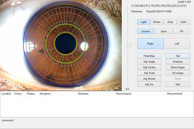 El analizador portátil del analizador del iris del ojo del PDA del CE para la salud detecta