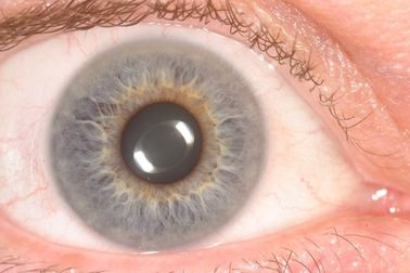 El analizador portátil del analizador del iris del ojo del PDA del CE para la salud detecta