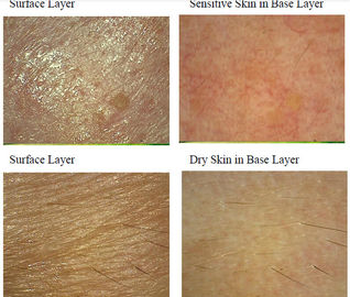 Máquina ultravioleta facial del analizador de la piel para la piel Mositure/grasa/arruga/pigmentación