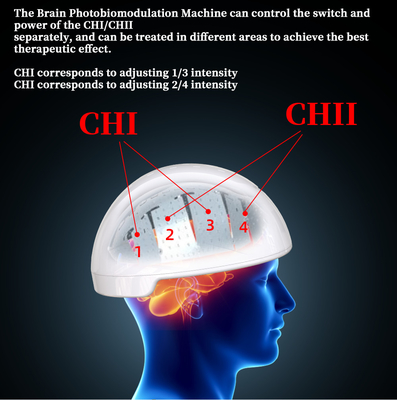 Terapia Brain Helmet Transcranial Magnetic Stimulator Photobiomodulation de Rtms
