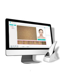 Portable Facial Skin Scope Analyzer Diagnosis System Beauty Skin Scope Machine
