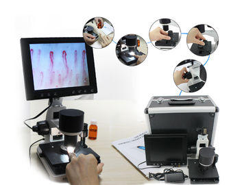 prueba capilar del repliegue del dermis del microscopio de la microcirculación 600cd/m2 conectada con el ordenador portátil
