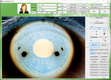 aprobación de la máquina de prueba del ojo de la cámara de 12.0MP Digitaces Iriscope Iridology CE/DHL