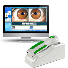 Analizador de la cámara de Iriscope Iridology del ojo, pixeles MEGA del escáner 12,00 portátiles de Digitaces USB Iriscope