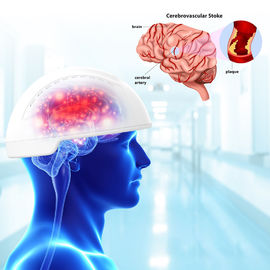 Longitud de onda traumática de los dispositivos 810nm de Photobiomodulation del cerebro de la lesión cerebral