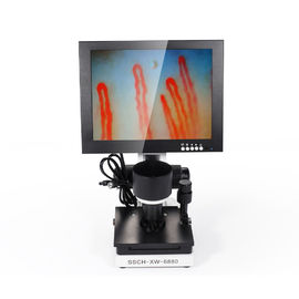 Portable máquina de la prueba de la microcirculación de Capillaroscopy del doblez del clavo de la pantalla LED de 10 pulgadas