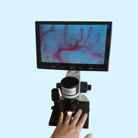 Microscopio para el nutricionista, microscopio de la microcirculación del repliegue del dermis del clavo