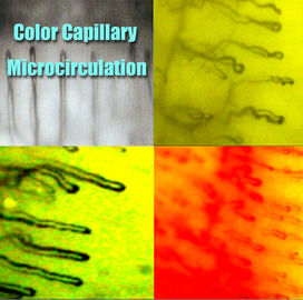 Microscopia capilar del repliegue del dermis del hospital/función multi del microscopio de la microcirculación para médico