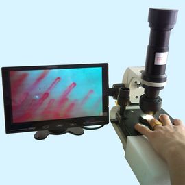 Microscopia capilar del repliegue del dermis del hospital/función multi del microscopio de la microcirculación para médico