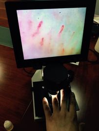 Microscopio aprobado de la microcirculación del color de la pantalla del OEM LCD del CE para la comprobación del clavo