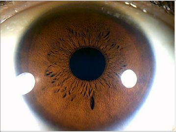 Analizador médico del iris del ojo de la cámara digital del megapíxel del alcance del iris de 12.0MP USB